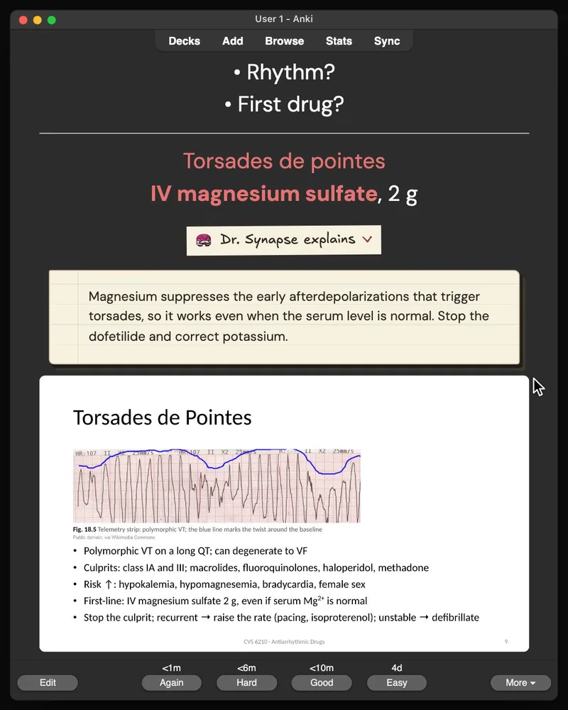 A card from the 32-card deck open in Anki: the answer, Dr. Synapse’s explanation and the lecture slide it came from
