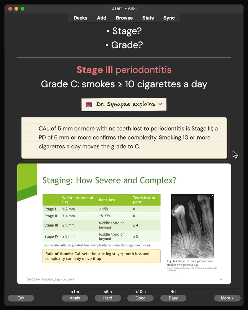 A card from the 30-card deck open in Anki: the answer, Dr. Synapse’s explanation and the lecture slide it came from