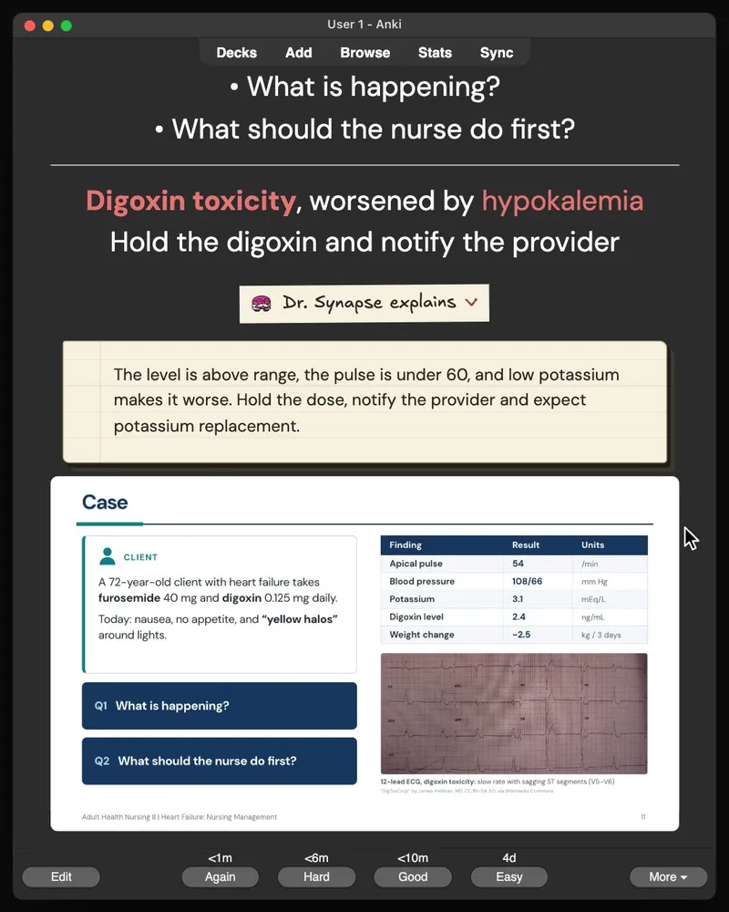 A card from the 21-card deck open in Anki: the answer, Dr. Synapse’s explanation and the lecture slide it came from