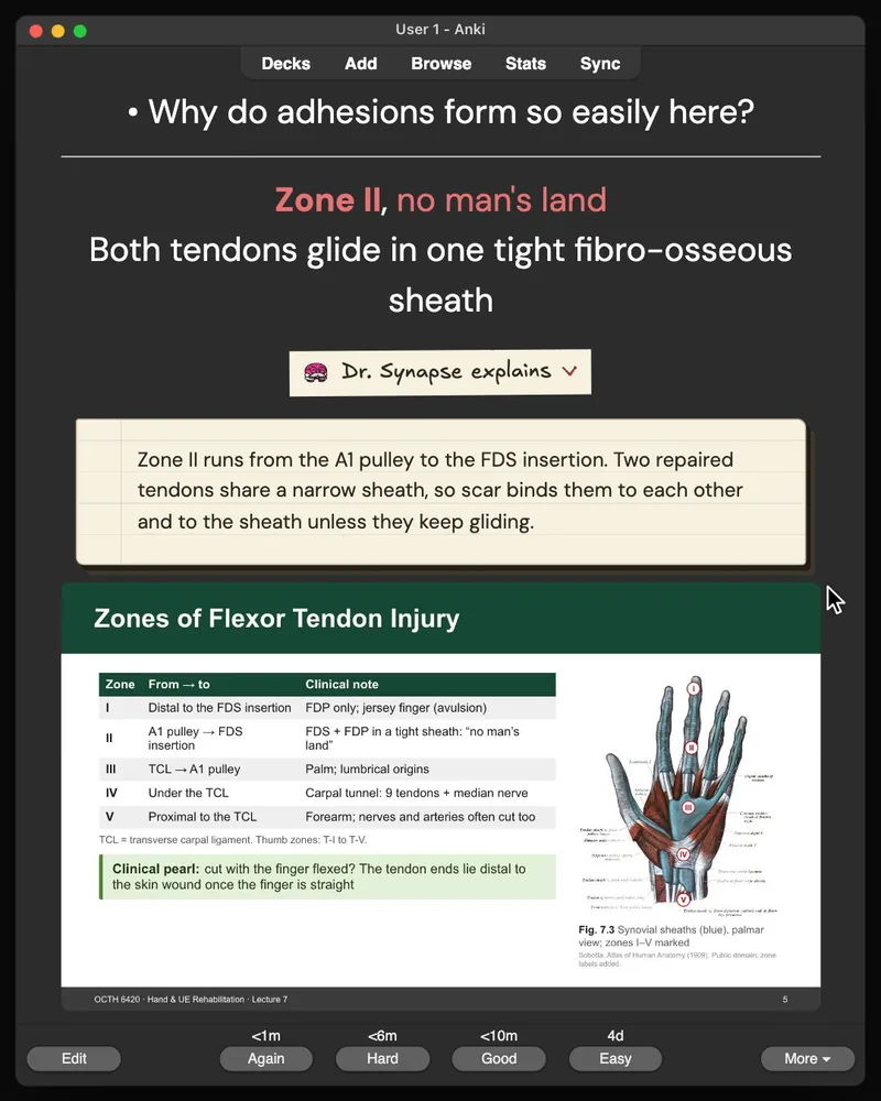 A card from the 32-card deck open in Anki: the answer, Dr. Synapse’s explanation and the lecture slide it came from