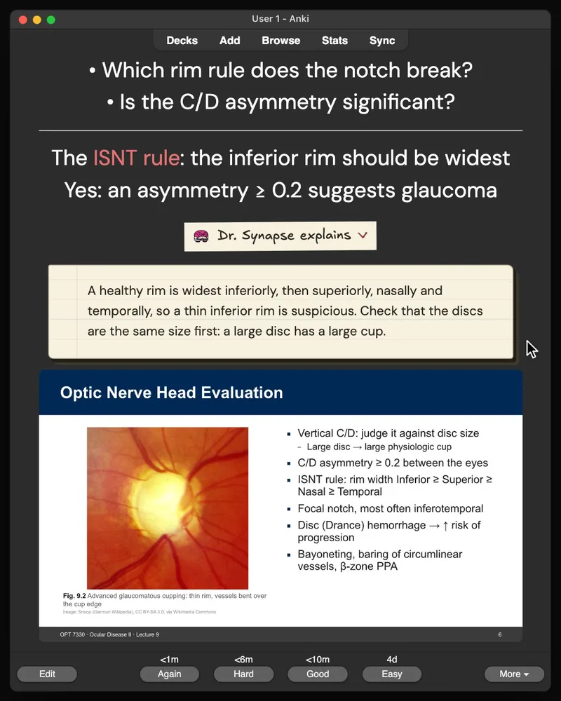 A card from the 30-card deck open in Anki: the answer, Dr. Synapse’s explanation and the lecture slide it came from