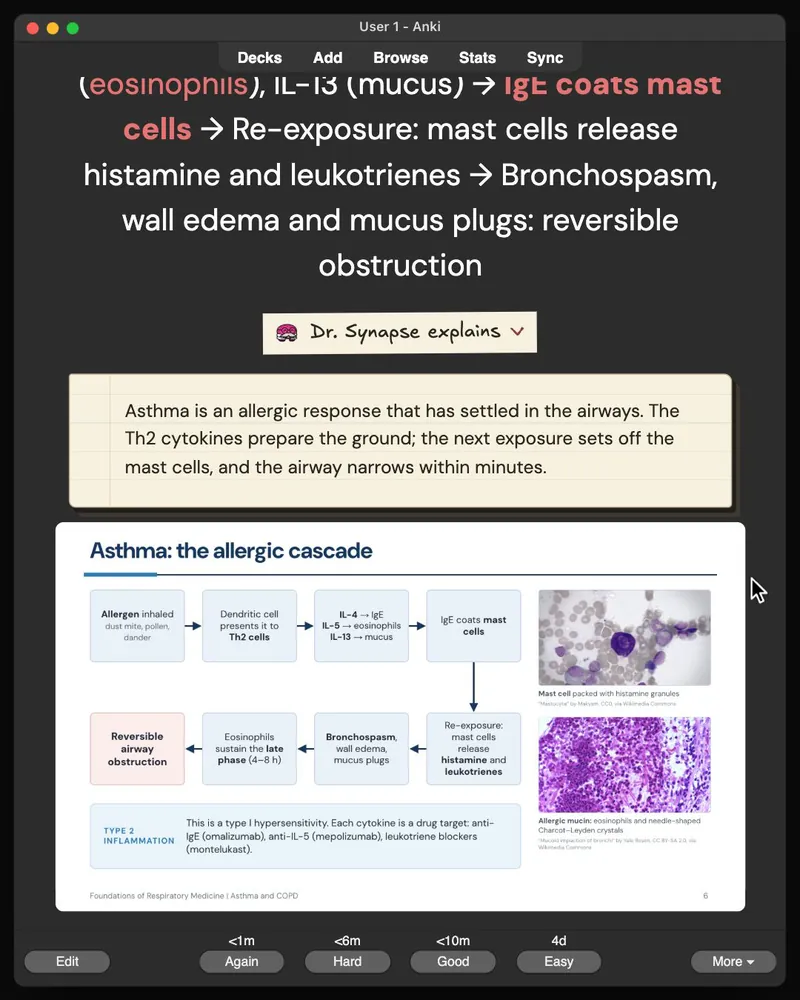 A card from the 32-card deck open in Anki: the answer, Dr. Synapse’s explanation and the lecture slide it came from