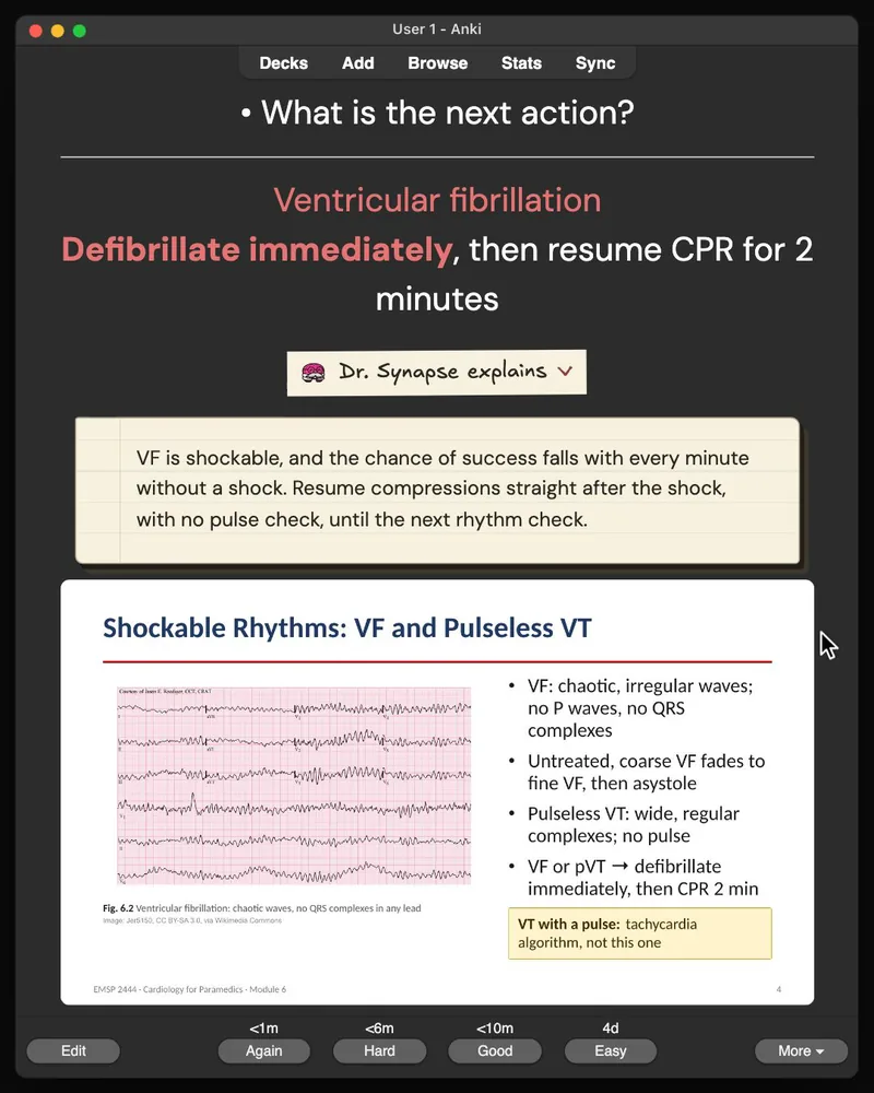 A card from the 32-card deck open in Anki: the answer, Dr. Synapse’s explanation and the lecture slide it came from