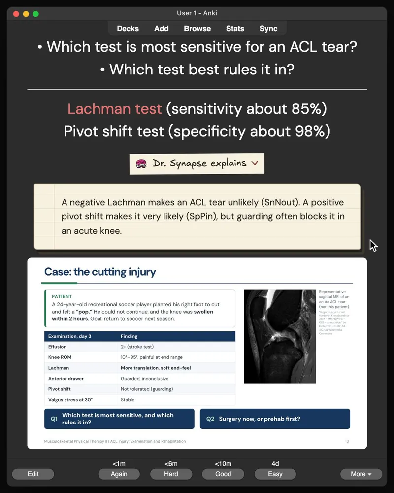 A card from the 29-card deck open in Anki: the answer, Dr. Synapse’s explanation and the lecture slide it came from