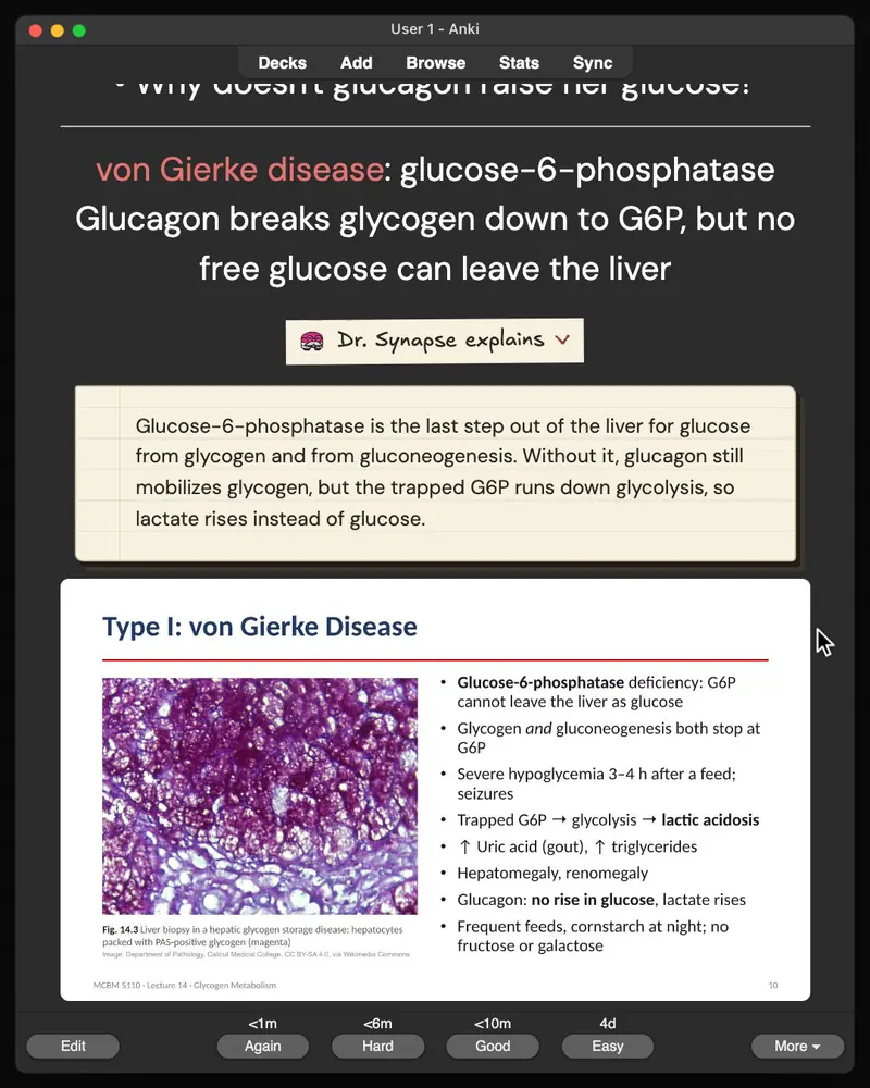 A card from the 31-card deck open in Anki: the answer, Dr. Synapse’s explanation and the lecture slide it came from