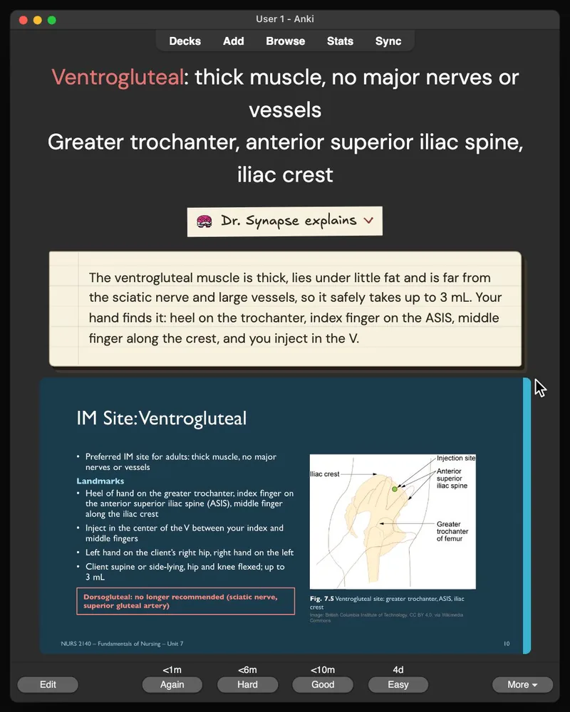 A card from the 31-card deck open in Anki: the answer, Dr. Synapse’s explanation and the lecture slide it came from