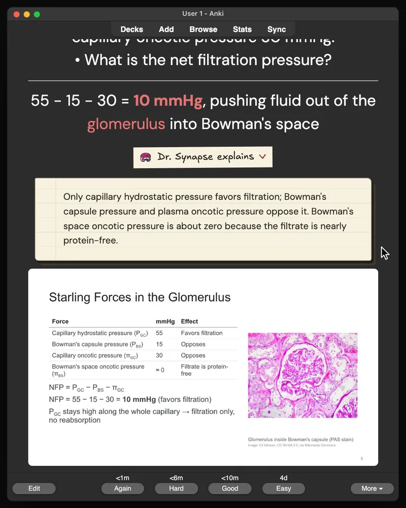 A card from the 30-card deck open in Anki: the answer, Dr. Synapse’s explanation and the lecture slide it came from