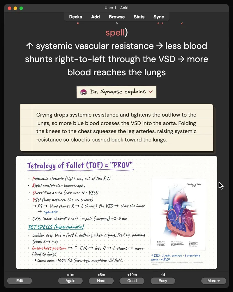 A card from the 30-card deck open in Anki: the answer, Dr. Synapse’s explanation and the lecture slide it came from