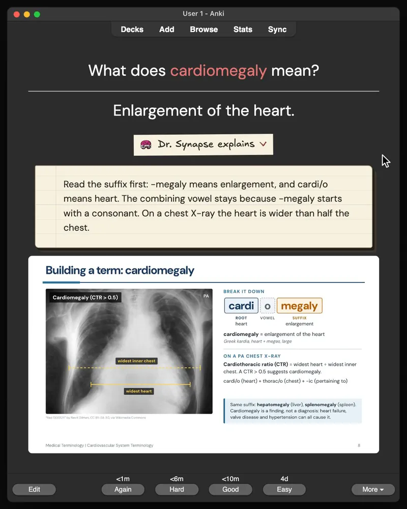 A card from the 32-card deck open in Anki: the answer, Dr. Synapse’s explanation and the lecture slide it came from