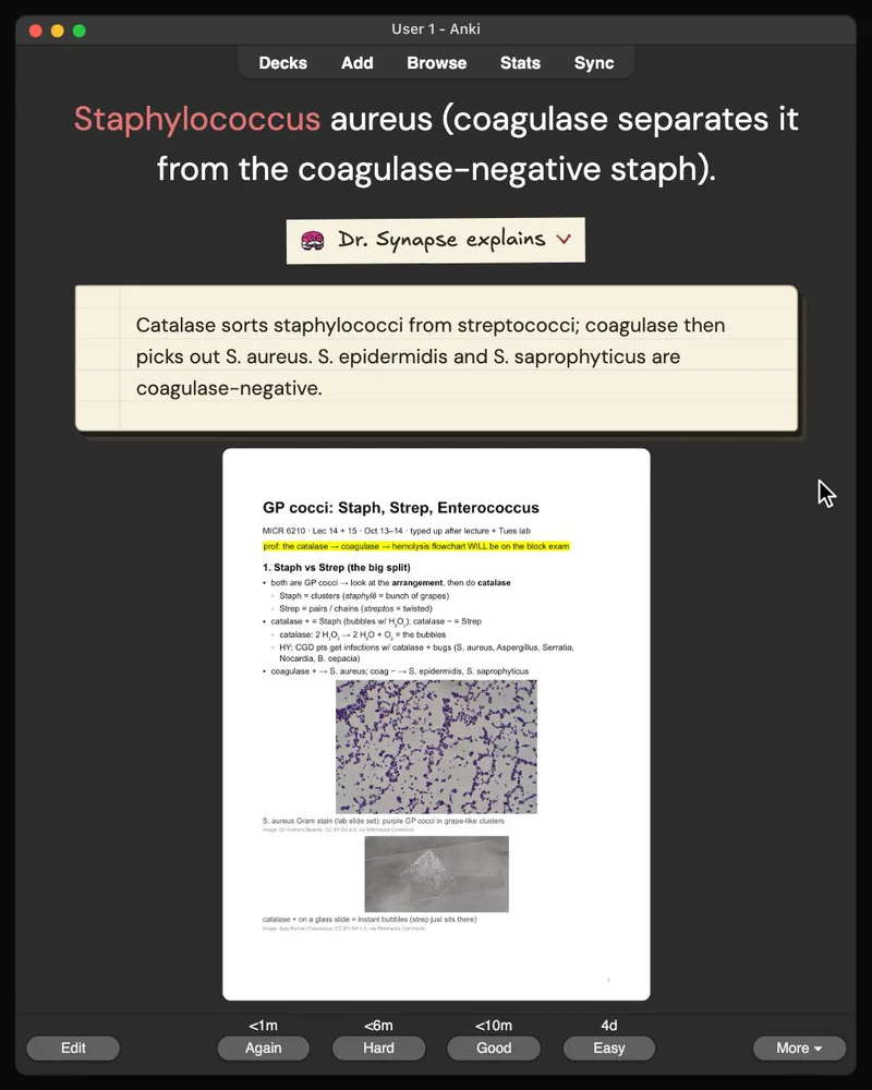 A card from the 30-card deck open in Anki: the answer, Dr. Synapse’s explanation and the lecture slide it came from