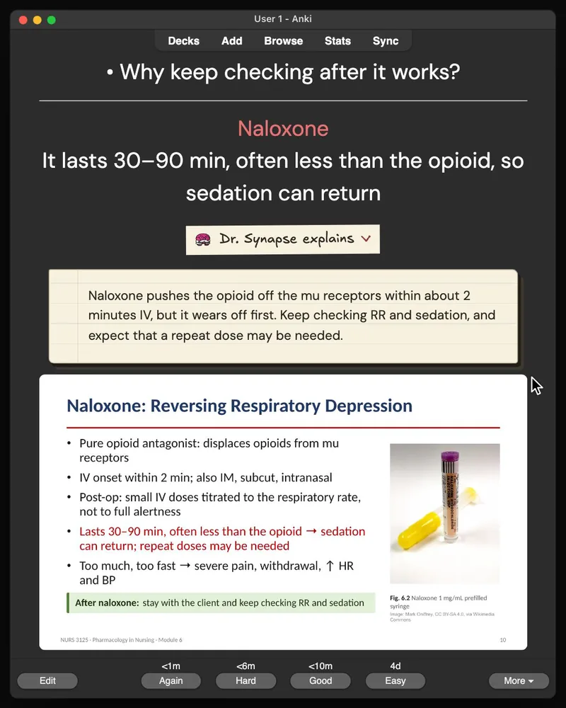 A card from the 31-card deck open in Anki: the answer, Dr. Synapse’s explanation and the lecture slide it came from