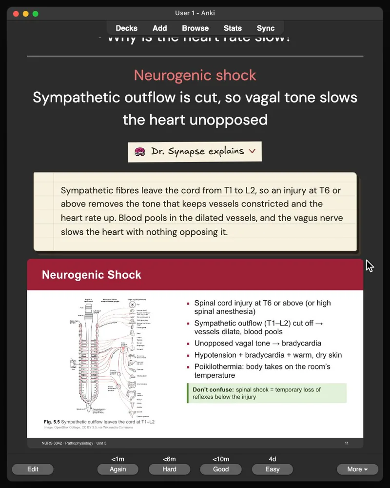 A card from the 31-card deck open in Anki: the answer, Dr. Synapse’s explanation and the lecture slide it came from