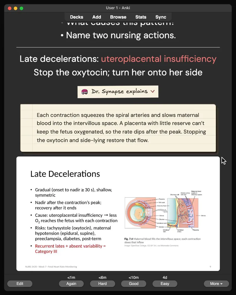 A card from the 31-card deck open in Anki: the answer, Dr. Synapse’s explanation and the lecture slide it came from