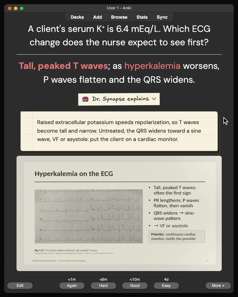 A card from the 32-card deck open in Anki: the answer, Dr. Synapse’s explanation and the lecture slide it came from